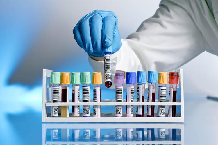 a gloved hand places blood specimen tubes in a tray